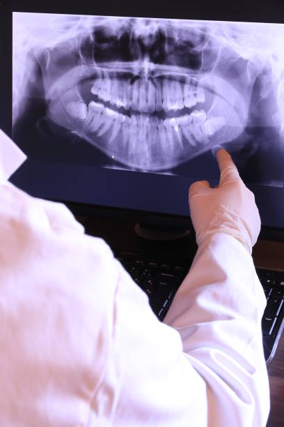 Best Emergency Dental Extractions in Estill, SC