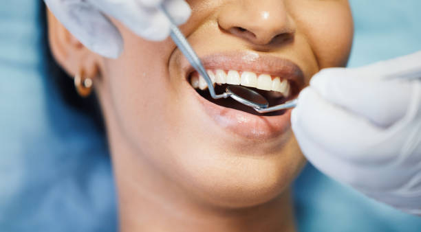 Best Mobile Emergency Dentist in Estill, SC