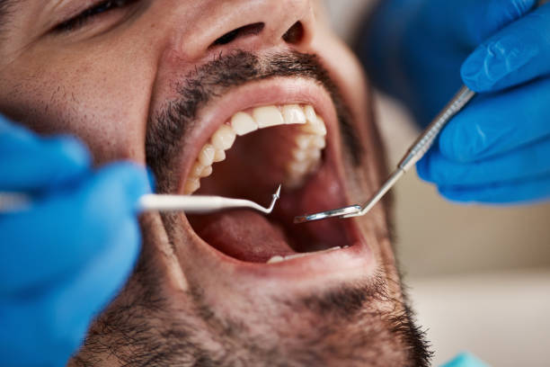 Best Broken or Cracked Tooth Emergency Dentist in Estill, SC